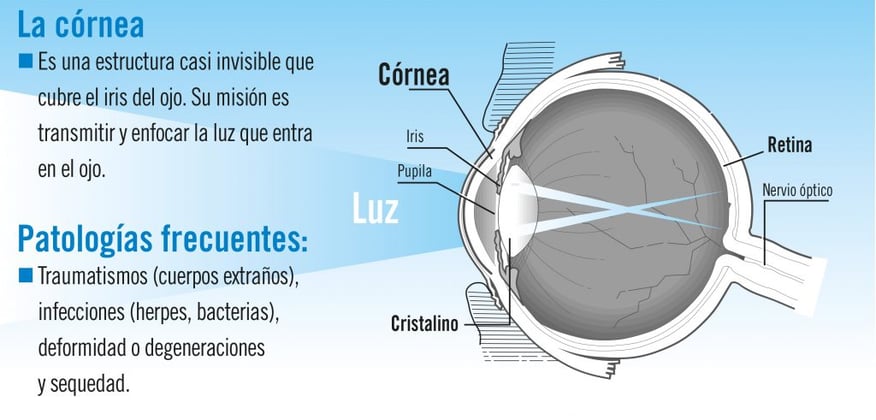 patologías de córnea