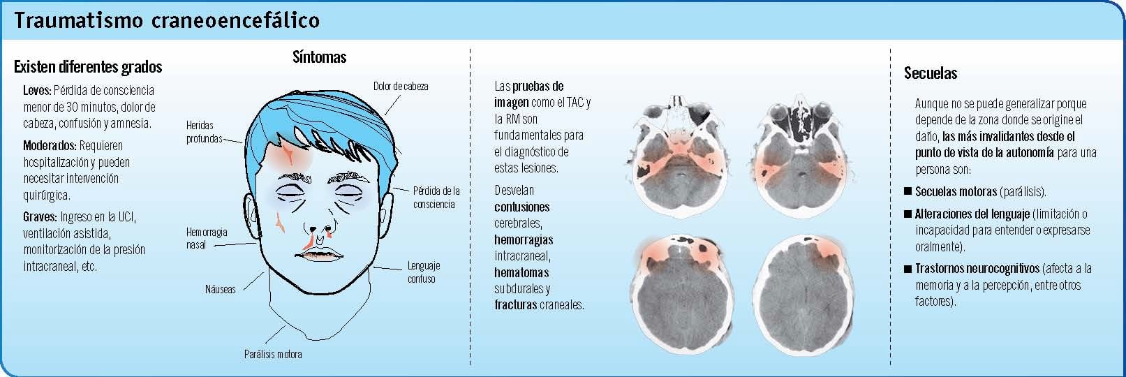 El peligro de los golpes en la cabeza